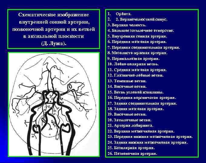 Схематическое изображение внутренней cонной артерии, позвоночной артерии и их ветвей в аксиальной плоскости (Д.