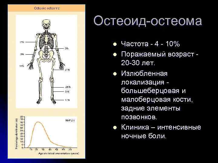 Остеоид-остеома l l Частота - 4 - 10% Поражаемый возраст - 20 -30 лет.
