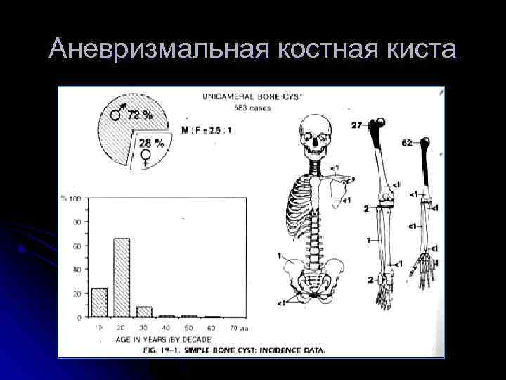 Аневризмальная костная киста 