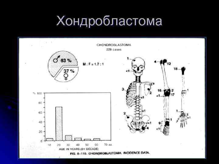Хондробластома 