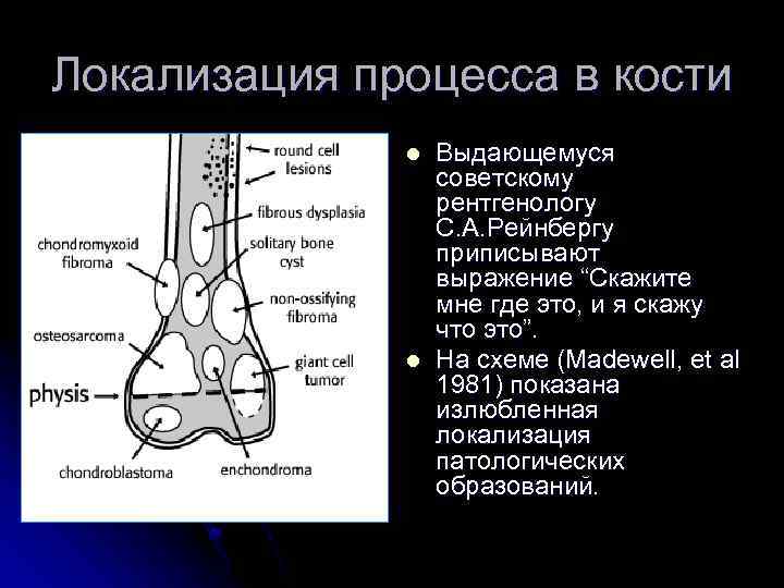 Локализация процесса в кости l l Выдающемуся советскому рентгенологу С. А. Рейнбергу приписывают выражение