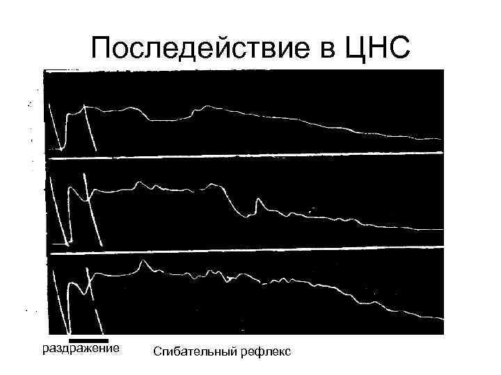 Последействие в ЦНС раздражение Сгибательный рефлекс 