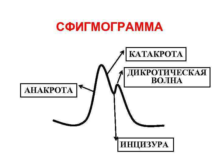 СФИГМОГРАММА КАТАКРОТА ДИКРОТИЧЕСКАЯ ВОЛНА АНАКРОТА ИНЦИЗУРА 