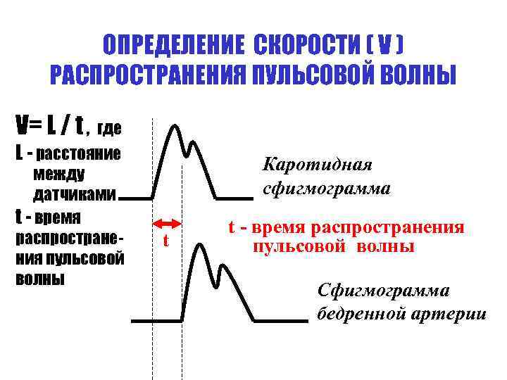 ОПРЕДЕЛЕНИЕ СКОРОСТИ ( V ) РАСПРОСТРАНЕНИЯ ПУЛЬСОВОЙ ВОЛНЫ V= L / t , где