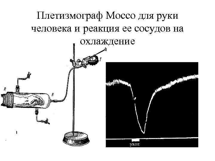 Плетизмограф Моссо для руки человека и реакция ее сосудов на охлаждение укол 