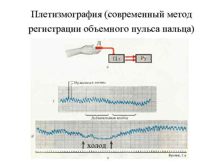 Плетизмография (современный метод регистрации объемного пульса пальца) холод 