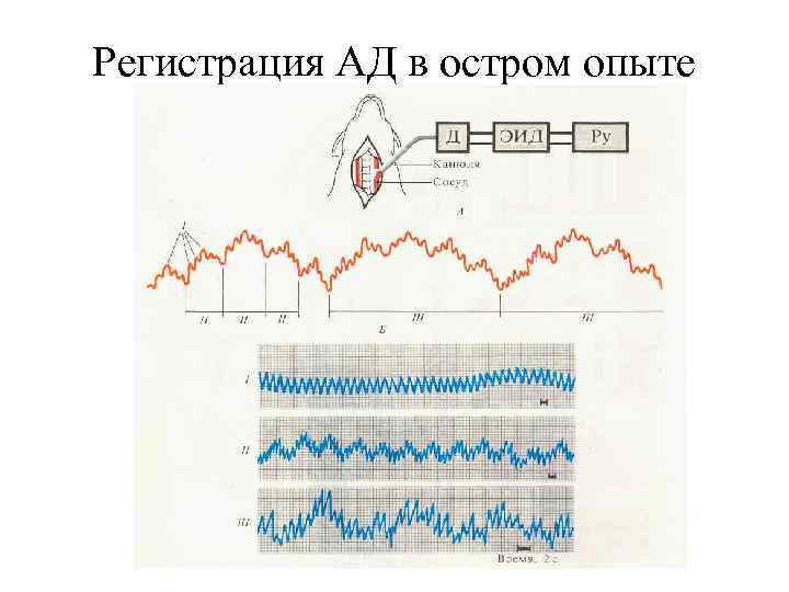 Регистрация АД в остром опыте 