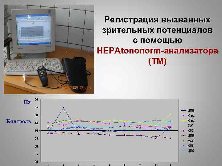 Регистрация вызванных зрительных потенциалов с помощью НЕРАtononorm-анализатора (ТМ) Hz Hz Контроль 