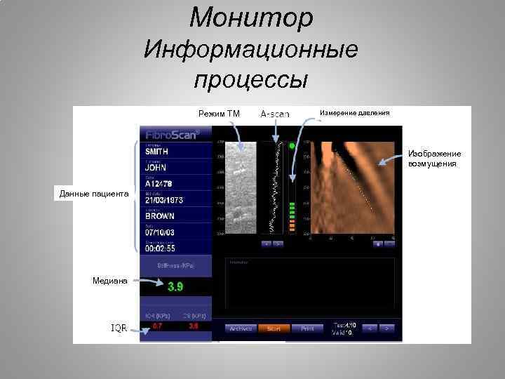 Монитор Информационные процессы Режим TM Измерение давления Изображение возмущения Данные пациента Медиана 