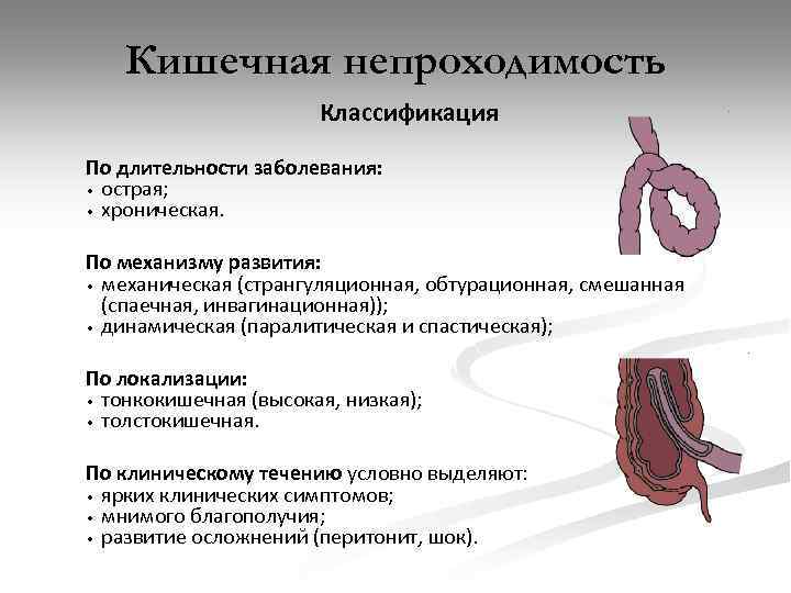 Кишечная непроходимость Классификация По длительности заболевания: • острая; • хроническая. По механизму развития: •