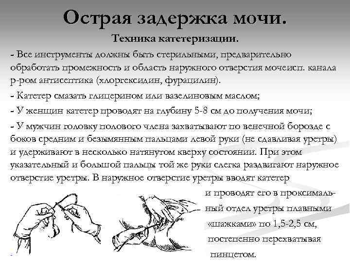 Острая задержка мочи. Техника катетеризации. - Все инструменты должны быть стерильными, предварительно обработать промежность