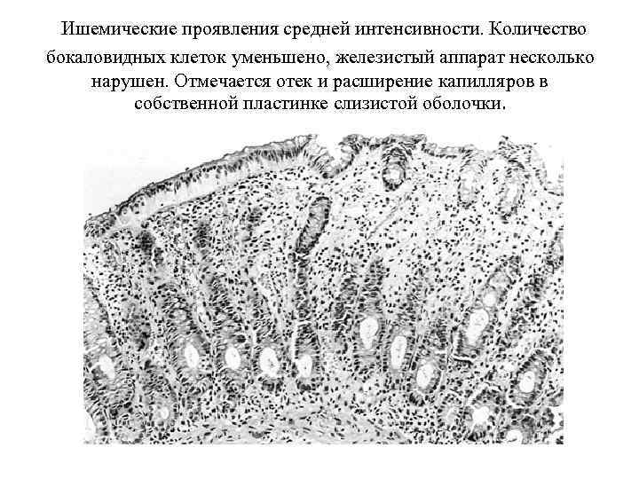 Скопления рецепторов на стенках мешочков преддверия образуют