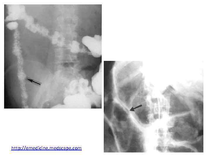 http: //emedicine. medscape. com 