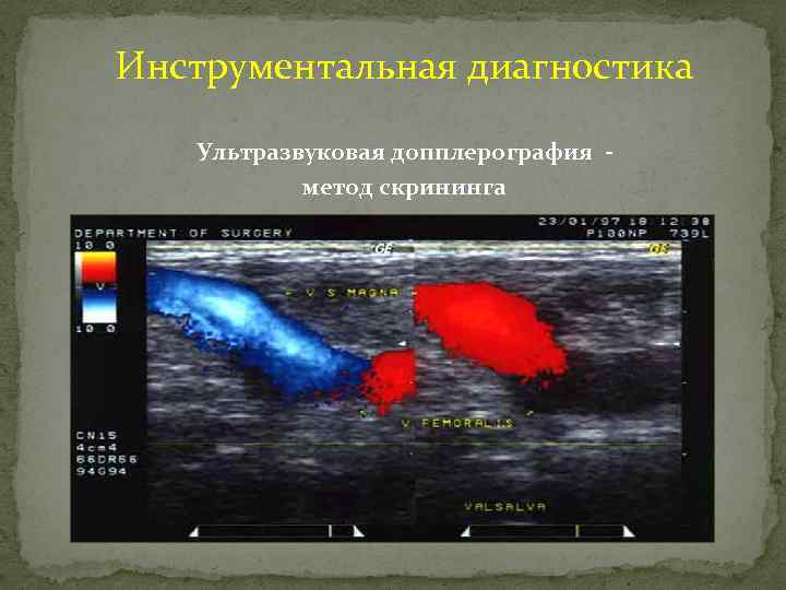 Инструментальная диагностика Ультразвуковая допплерография метод скрининга 