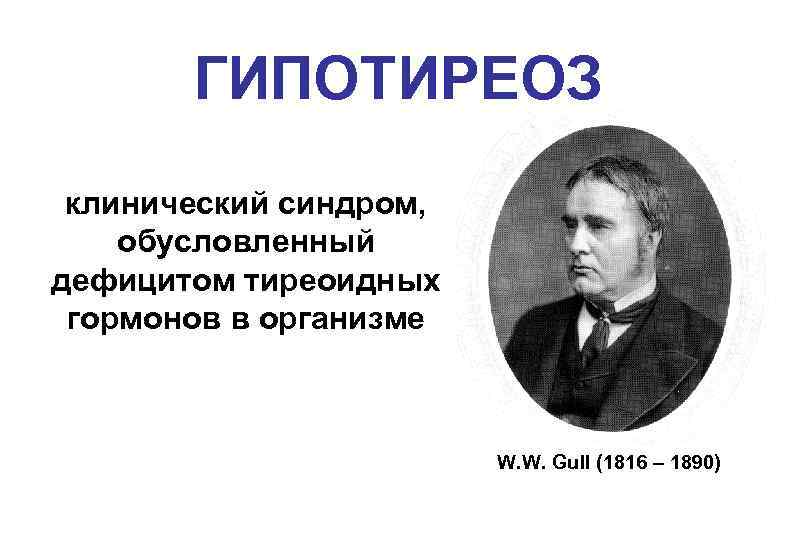 ГИПОТИРЕОЗ клинический синдром, обусловленный дефицитом тиреоидных гормонов в организме W. W. Gull (1816 –