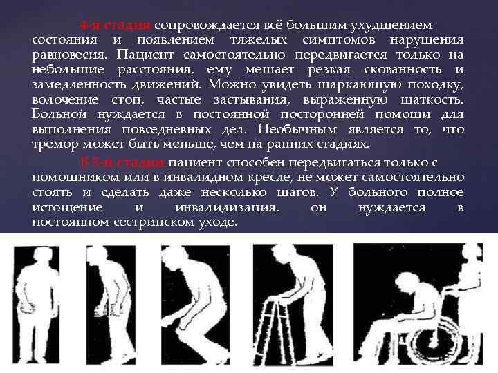 4 -я стадия сопровождается всё большим ухудшением состояния и появлением тяжелых симптомов нарушения равновесия.