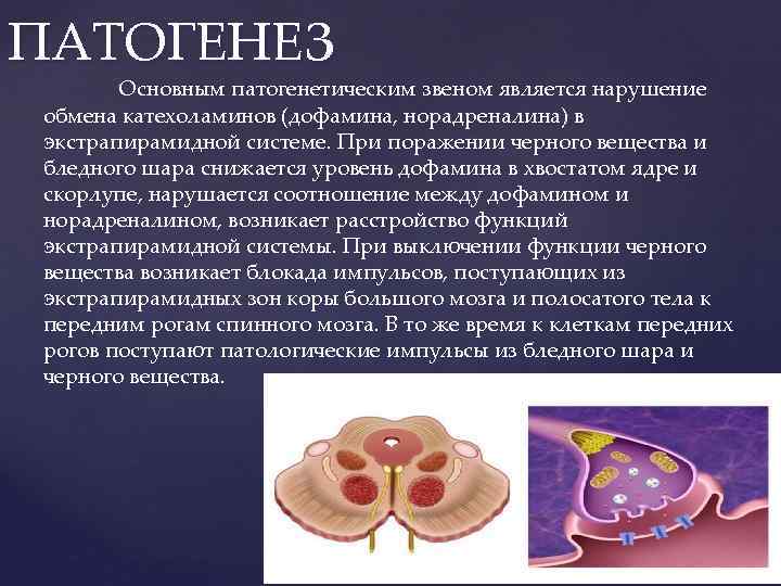 ПАТОГЕНЕЗ Основным патогенетическим звеном является нарушение обмена катехоламинов (дофамина, норадреналина) в экстрапирамидной системе. При