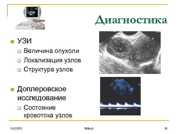 Диагностика n УЗИ q q q n Величина опухоли Локализация узлов Структура узлов Доплеровское