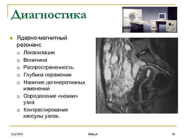 Диагностика n Ядерно-магнитный резонанс q q q q 2/6/2018 Локализация Величина Распространенность Глубина поражения