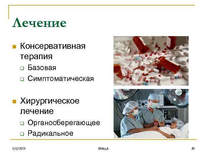 Лечение n Консервативная терапия q q n Базовая Симптоматическая Хирургическое лечение q q 2/6/2018