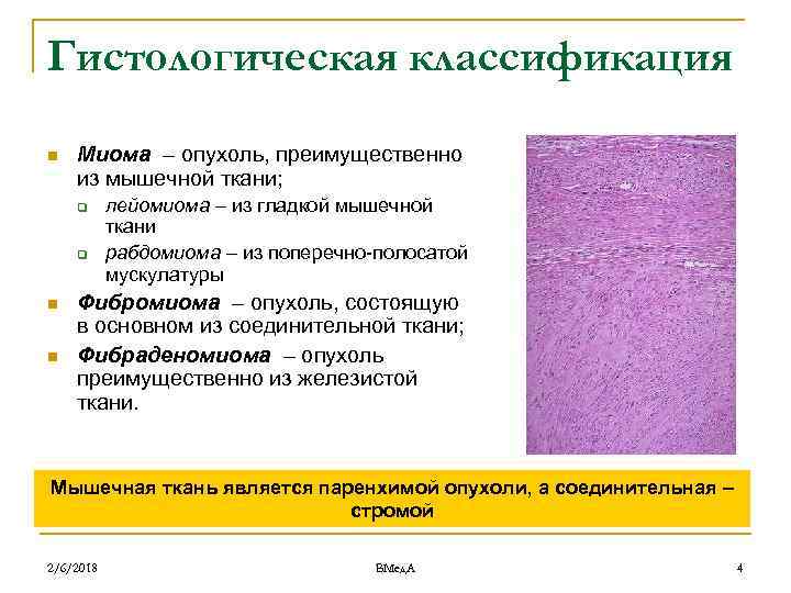 Гистологическая классификация n Миома – опухоль, преимущественно из мышечной ткани; q q n n