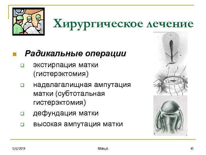 Хирургическое лечение Радикальные операции n q q 2/6/2018 экстирпация матки (гистерэктомия) надвлагалищная ампутация матки