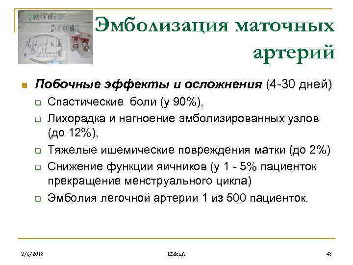 Эмболизация маточных артерий n Побочные эффекты и осложнения (4 -30 дней) q q q