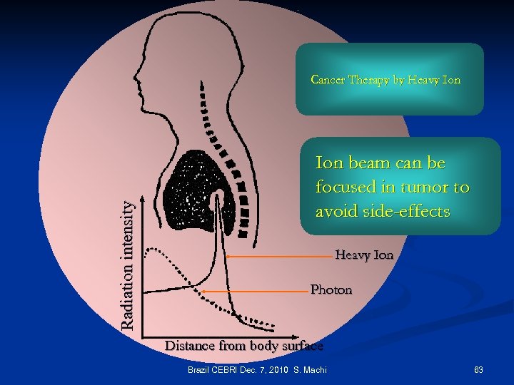 Radiation intensity Cancer Therapy by Heavy Ion beam can be focused in tumor to