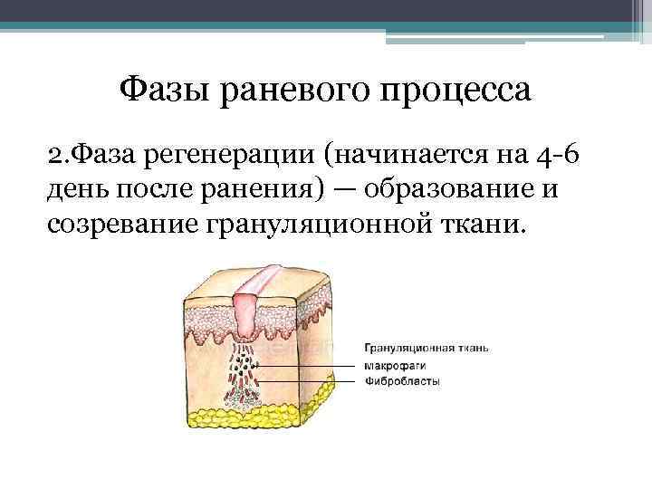 Фазы раневого процесса 2. Фаза регенерации (начинается на 4 6 день после ранения) —