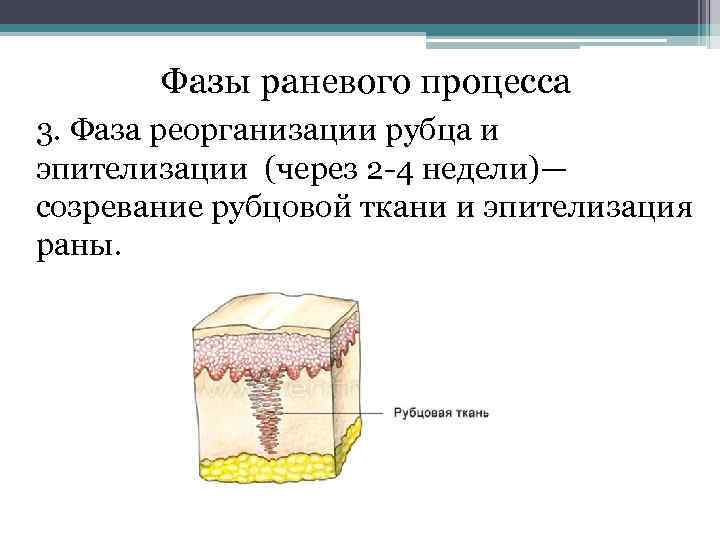 Фазы раневого процесса 3. Фаза реорганизации рубца и эпителизации (через 2 4 недели)— созревание