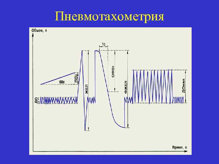 Пневмотахометрия 