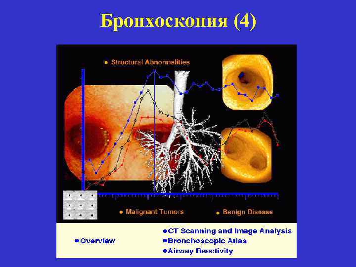 Бронхоскопия (4) 