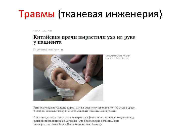Травмы (тканевая инженерия) 