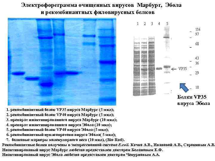  Электрофореграмма очищенных вирусов Марбург, Эбола и рекомбинантных филовирусных белков Белки VP 35 вируса