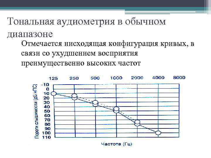 Тональная аудиометрия в обычном диапазоне Отмечается нисходящая конфигурация кривых, в связи со ухудшением восприятия