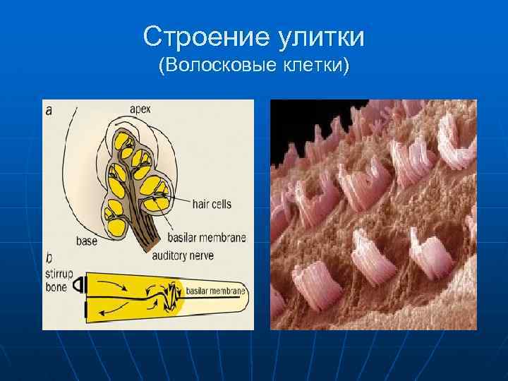 Строение улитки (Волосковые клетки) 