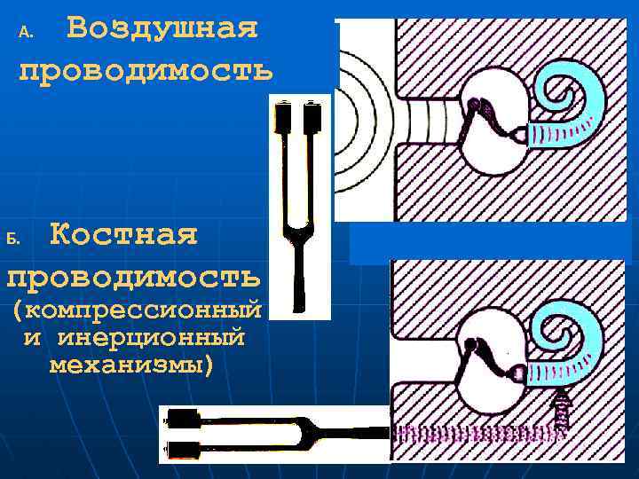 Воздушная проводимость А. Костная проводимость Б. (компрессионный и инерционный механизмы) 