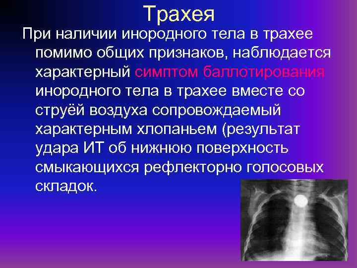 Трахея При наличии инородного тела в трахее помимо общих признаков, наблюдается характерный симптом баллотирования