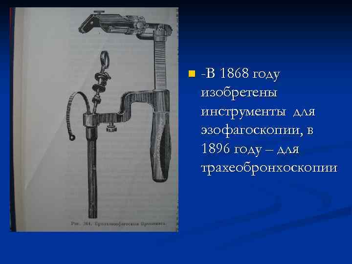 n -В 1868 году изобретены инструменты для эзофагоскопии, в 1896 году – для трахеобронхоскопии