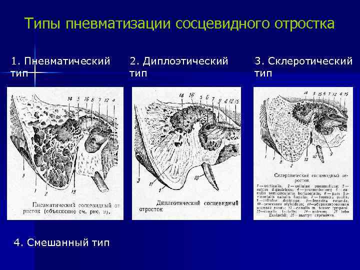 Острый отит карта вызова смп