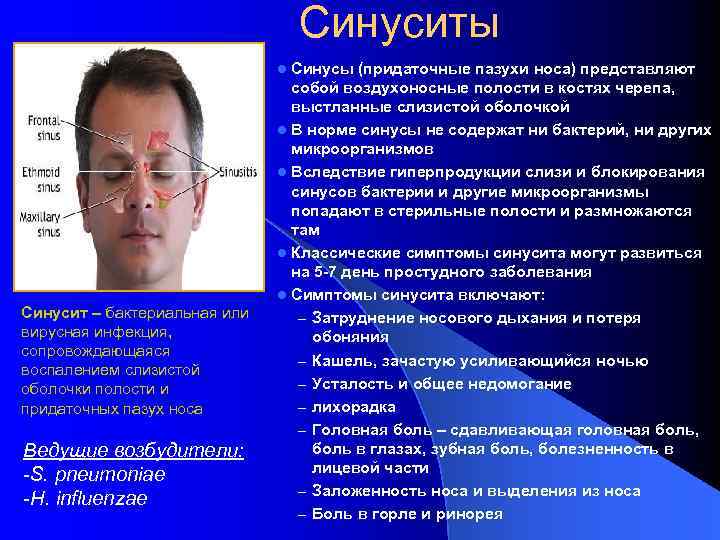 Синуситы Синусы (придаточные пазухи носа) представляют собой воздухоносные полости в костях черепа, выстланные слизистой