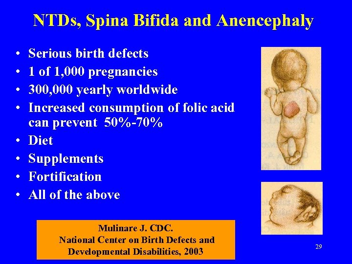 NTDs, Spina Bifida and Anencephaly • • Serious birth defects 1 of 1, 000
