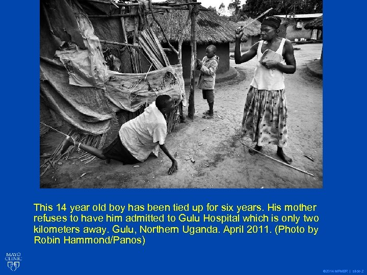 This 14 year old boy has been tied up for six years. His mother