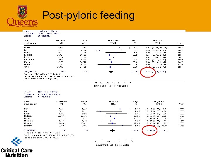Post-pyloric feeding 