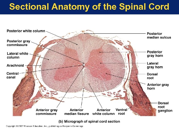 Sectional Anatomy of the Spinal Cord 