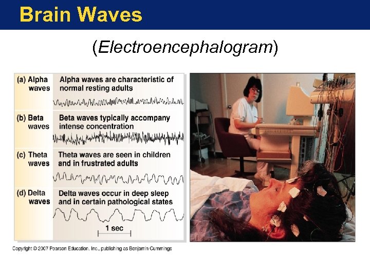 Brain Waves (Electroencephalogram) 