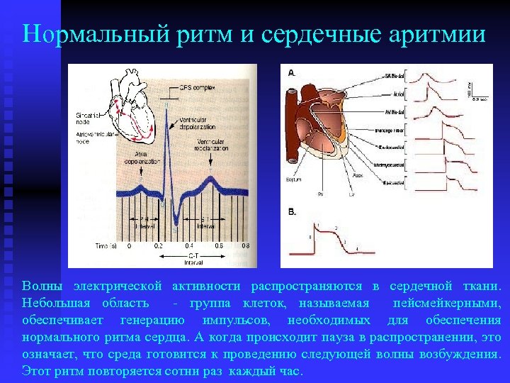 Нормальный ритм и сердечные аритмии Волны электрической активности распространяются в сердечной ткани. Небольшая область