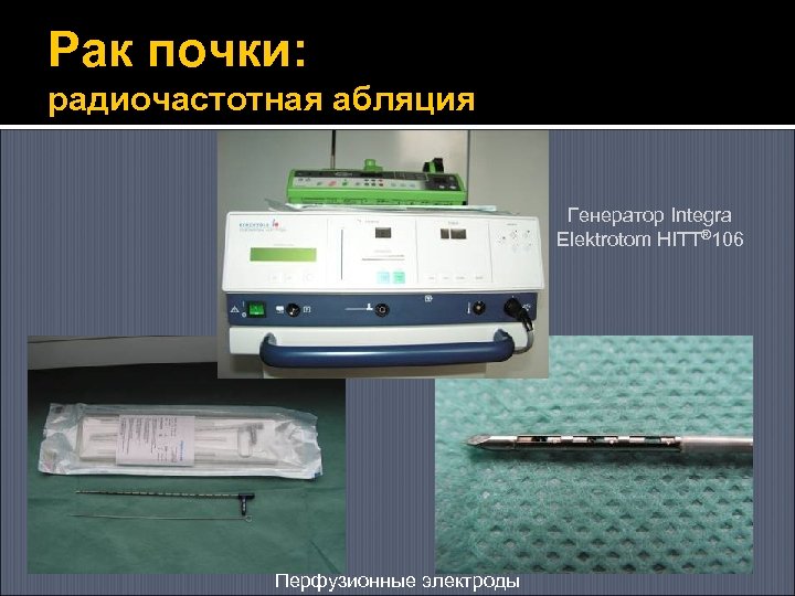 Рак почки: радиочастотная абляция Генератор Integra Elektrotom HITT® 106 Перфузионные электроды 