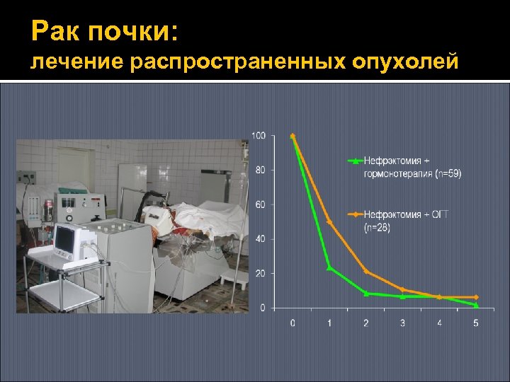 Рак почки: лечение распространенных опухолей 