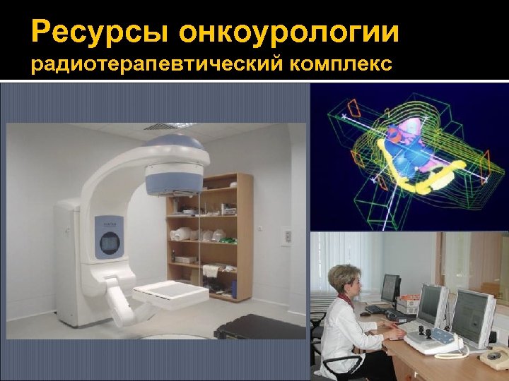 Ресурсы онкоурологии радиотерапевтический комплекс 